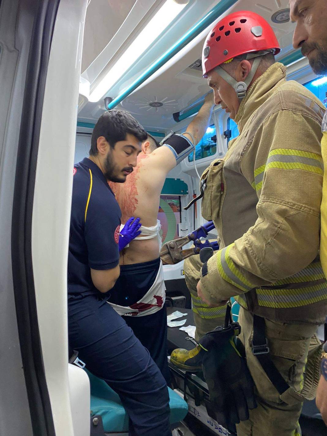 3 yıl önce zıpkınla yaralanmıştı, bu kez silahlı saldırıda öldü 2